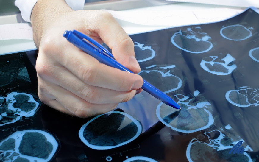 img-neurologia.jpg