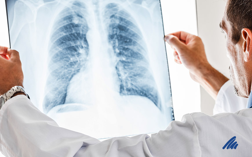 img-pneumologia.jpg