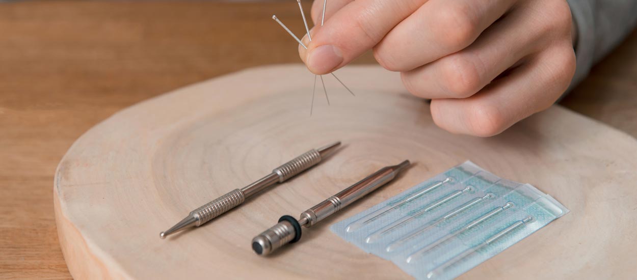 acupuncture-treatment