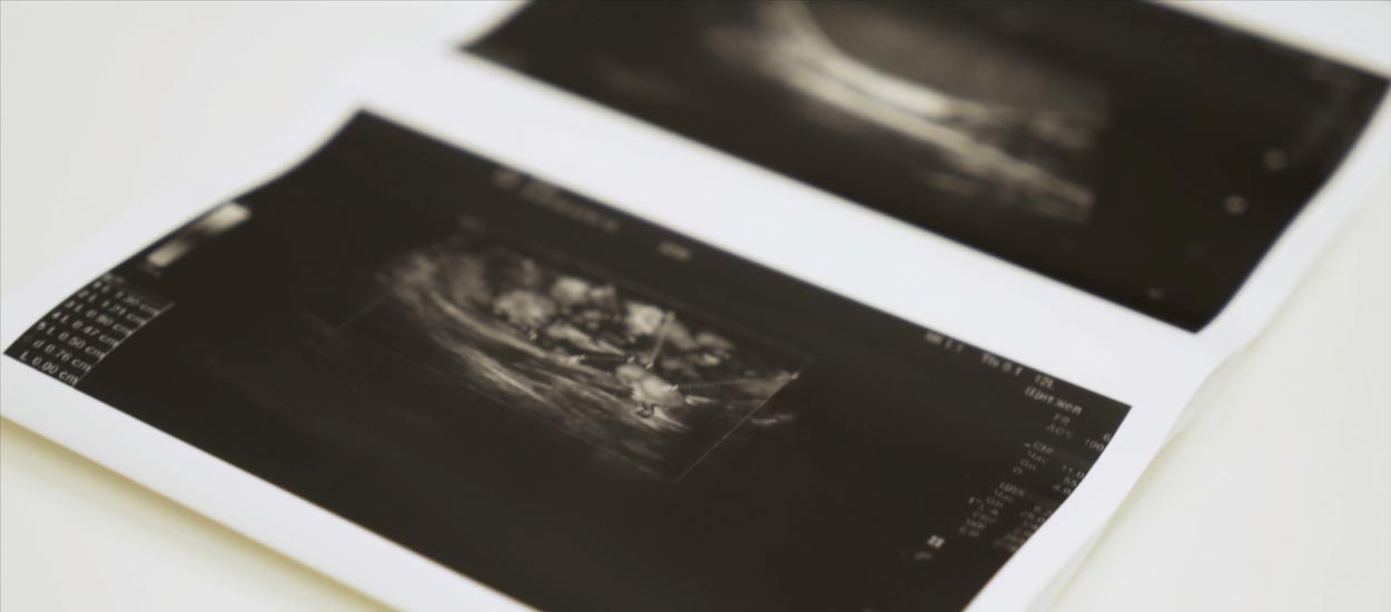 collection-of-images-from-ultrasound-scan-examinat